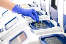 Tìm hiểu sự khác nhau của PCR và Real Time PCR hiện nay